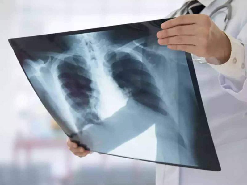 Digital X ray at Megavision Diagnostics Centres