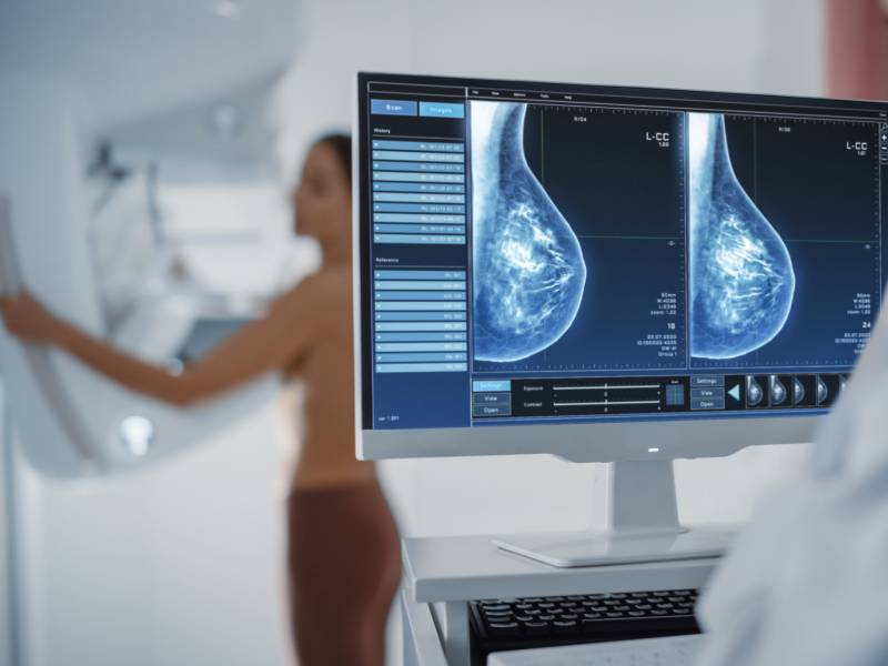 Mammography Test
